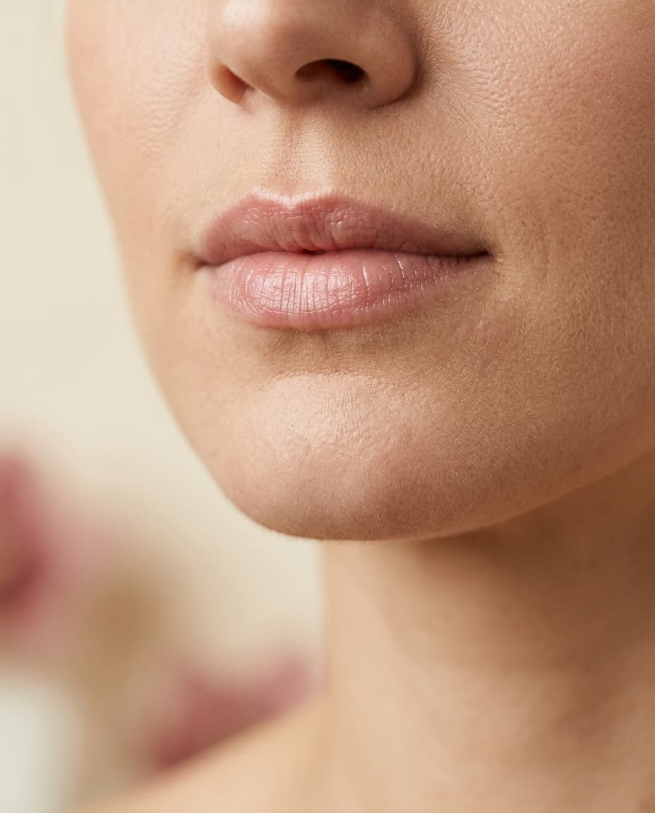 Close detail of a patient's lips after conservative hyaluronic-acid lip filler at The Beauty Spot Medspa in North Haven, Connecticut