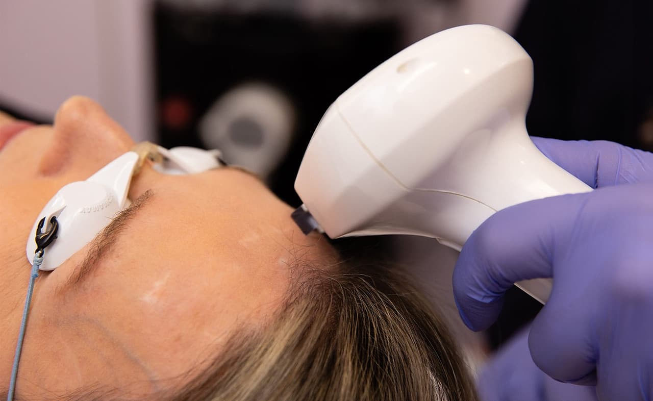 Lumecca IPL photofacial at The Beauty Spot Medspa.