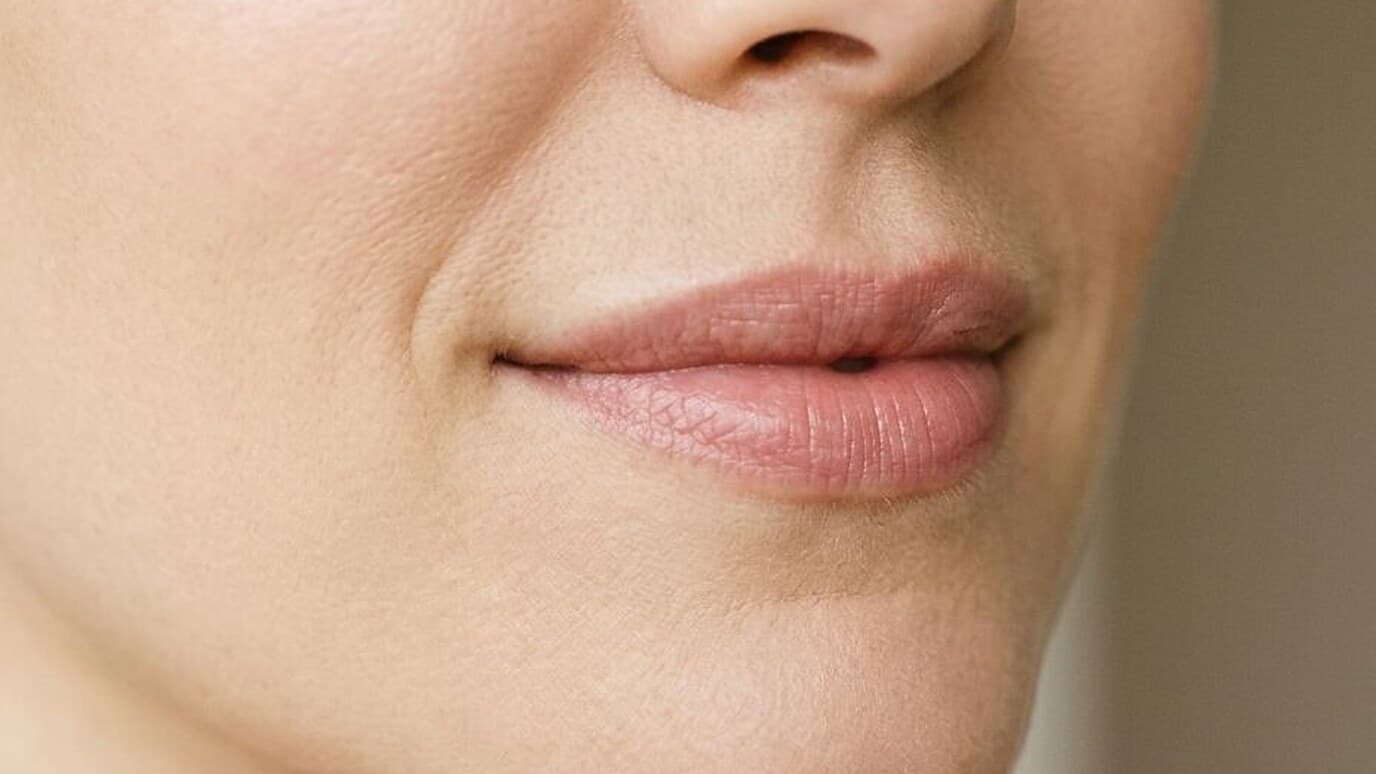 Close-up of a woman's relaxed mouth and lower face showing a natural, undone lip shape — the look a conservative lip flip or lip filler treatment aims to preserve.